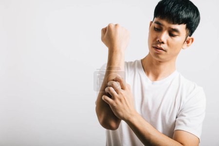 Téléchargez les photos : Portrait d'un homme asiatique malheureux qui se gratte le bras, reflétant des symptômes de dermatite et de gale, avec une allergie potentielle. Studio tourné isolé sur blanc, illustrant les problèmes de santé liés à la peau. - en image libre de droit