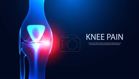 Illustration for Abstract Bone, Knee part Anatomy X-ray model showing knee injury with red light. For inserting text, articles or templates - Royalty Free Image