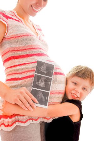Foto de Mujer embarazada con su hija sobre fondo blanco con ultrasonido - Imagen libre de derechos