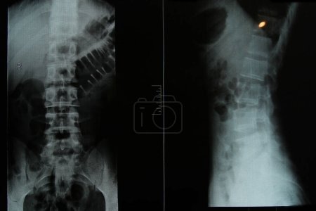 Foto de Medicina de columna vertebral de rayos X hombre sano - Imagen libre de derechos