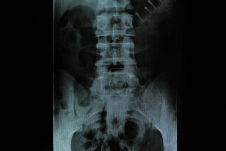 Foto de Medicina de columna vertebral de rayos X hombre saludable - Imagen libre de derechos
