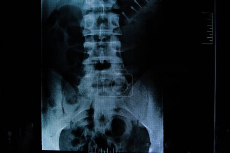 Téléchargez les photos : Image radiographique de la colonne vertébrale médicale - en image libre de droit