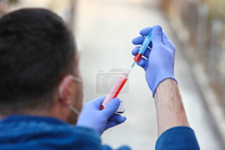 Téléchargez les photos : Test sanguin du coronavirus dans les mains d'un homme 2019-2020. Éclosion du virus Crown. Syndrome respiratoire viral épidémique. Chine - en image libre de droit