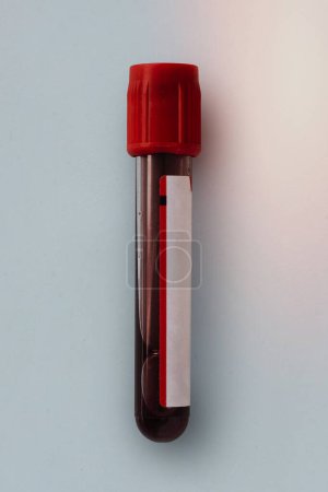 Blood test tube in a lab