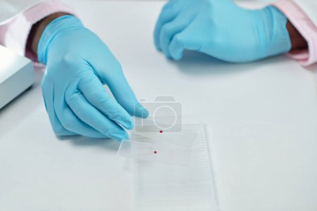 Téléchargez les photos : Hands of laboratory worker taking glass plates with drops of bllod - en image libre de droit