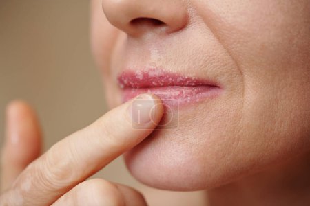 Téléchargez les photos : Image rapprochée de la femme frottant les lèvres pour se débarrasser des cellules mortes de la peau - en image libre de droit