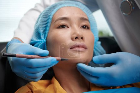 Téléchargez les photos : Marquage médical des zones sur le visage du patient avant chirurgie de lifting - en image libre de droit
