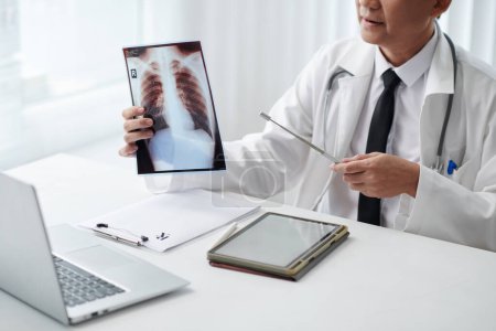 Téléchargez les photos : Image recadrée d'un médecin généraliste pointant la radiographie pulmonaire lors d'une séance de télémédecine avec un patient - en image libre de droit