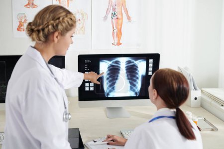 Photo for Pulmonologust and surgeon discussing chest x-ray of sick patient on computer screen - Royalty Free Image