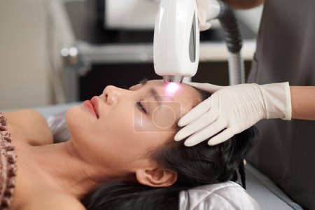 Photo for Closeup image of young woman getting forehead hair removed with laser - Royalty Free Image