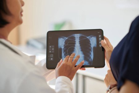 Foto de Pediatra discutiendo radiografía pulmonar con madre de paciente adolescente - Imagen libre de derechos