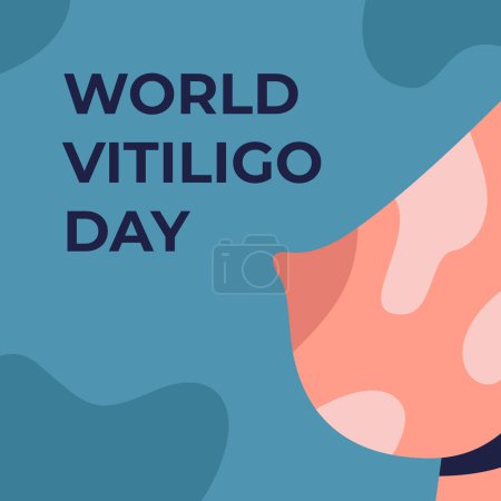 Illustration for Female breasts with white pigment spots on a blue background with the text World Vitiligo Day. Flat vector illustration for medical articles. Skin treatment concept. - Royalty Free Image