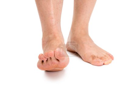 Männlicher Fuß isoliert auf weißem Hintergrund