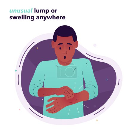 Illustration for Vector illustration of a frightened man who examines his hand. The man found a swelling on his hand. Symptoms of lipoma, cysts, tumors, and cancer. Illustration for medical articles, posters, stands - Royalty Free Image