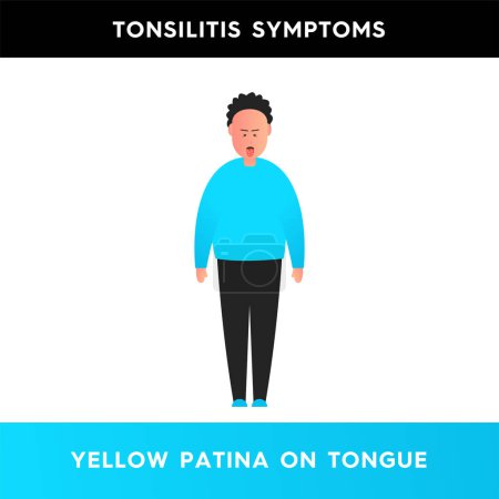 Illustration for Vector illustration of a man who has a yellow coating on his tongue. White-yellow dots on the tongue of a person with tonsillitis. Infectious diseases. Symptoms of tonsillitis - Royalty Free Image