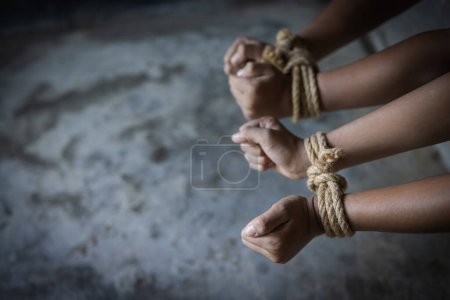 Photo for Child who are victims of the human trafficking process and have bruises on their faces.Child labor, Concept of ending violence against children and human rights. - Royalty Free Image