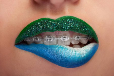 Photo for Close up mouth blue and green lips with glitter brackets. Fashion make up. Make up addiction. Artistic make up. Macro shooting. Sensuality and fashion concept - Royalty Free Image