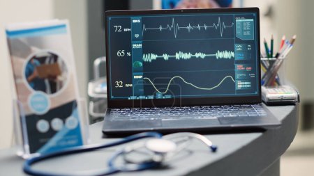 Pulsmesser am Laptop am Schalter, der ein Elektrokardiogramm zur kardiologischen Diagnose zeigt. Empfangsrezeption leer mit PC zur Herzschlagmessung. Handschuss. Nahaufnahme.