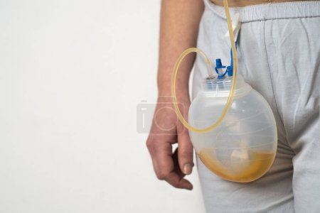 Photo for Surgical drainage on a patient filled with drained serous yellow fluid - Royalty Free Image