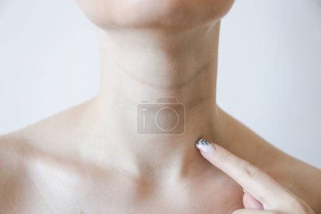 Téléchargez les photos : Anneaux de Vénus sur le cou. La cosmétologie. Rides sur le cou - en image libre de droit