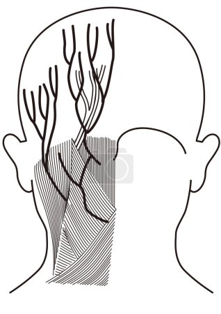 Illustration for Muscles and blood vessels in the back of the human head - Royalty Free Image