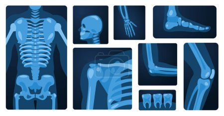 Ilustración de Partes del cuerpo de rayos X. Esqueleto humano rodilla brazo pecho muñeca pie, radiografía médica concepto de lesión ósea. Conjunto plano vectorial. Chequeo hospitalario, escaneo del cráneo del paciente, dientes y hombros - Imagen libre de derechos