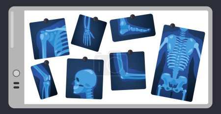 Téléchargez les illustrations : Rayon X sur l'écran du médecin. Pièces de squelette humain sur coussin lumineux chirurgie, parties du corps concept de radiographie médicale. Illustration vectorielle. Lésions osseuses, soins de santé. Crâne, jambe, genou et poitrine images - en licence libre de droit