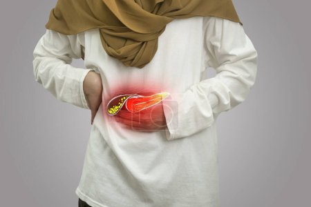 Foto de Composición digital de cálculos biliares humanos con inflamación roja destacada en personas enfermas, mujeres con dolor de estómago, salud y concepto médico - Imagen libre de derechos