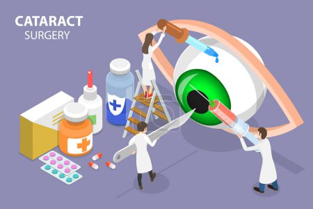 Illustration for 3D Isometric Flat Vector Conceptual Illustration of Cataract Surgery , Ophthalmology or Eye Treatment - Royalty Free Image