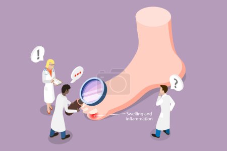 Illustration for 3D Isometric Flat Vector Conceptual Illustration of Ingrown Toenail, Swollen Toe - Royalty Free Image