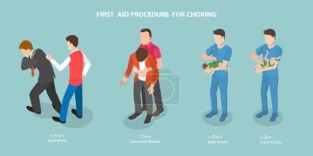 Illustration for 3D Isometric Flat Vector Conceptual Illustration of First Aid Procedure For Choking, Heimlich Maneuver - Royalty Free Image