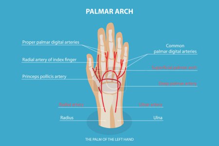 Téléchargez les illustrations : 3D Isometric Flat Vector Conceptual Illustration of Palmar ARCH, Health Care Labeled Guide - en licence libre de droit