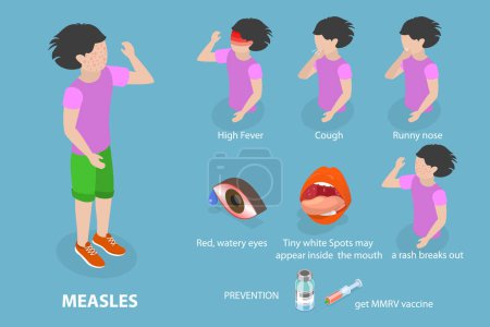 Illustration for 3D Isometric Flat Vector Conceptual Illustration of Measles, Red Rash - Royalty Free Image