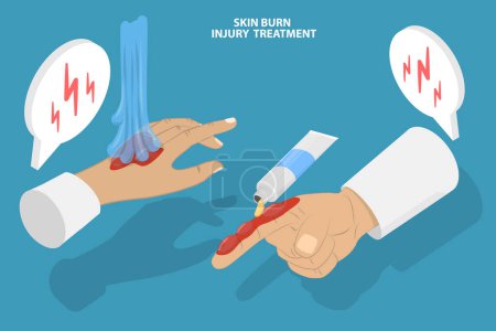 Illustration for 3D Isometric Flat Vector Conceptual Illustration of Skin Burn Injury Treatment, Ointment Wound Care - Royalty Free Image