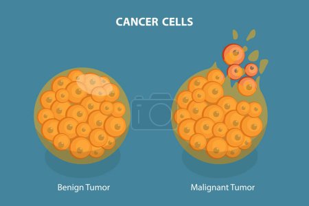 Illustration for 3D Isometric Flat Vector Illustration of Cancer Cells, Tumor Development - Royalty Free Image