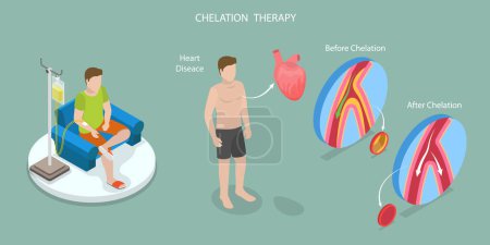 Illustration for 3D Isometric Flat Vector Illustration of Chelation Therapy, Toxic Heavy Metal Medical Treatment - Royalty Free Image