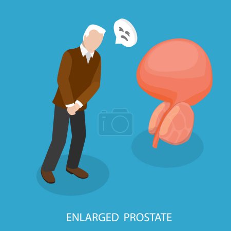 Illustration vectorielle plane isométrique 3D de la prostate élargie, problèmes du système reproducteur masculin