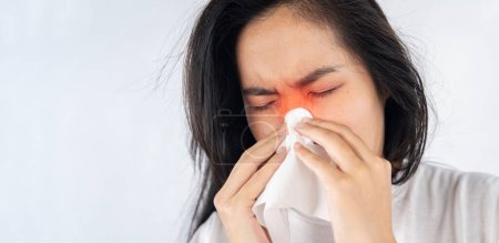 Photo for A woman with a runny nose is blowing her nose with a tissue. She has a red eye and is in pain. - Royalty Free Image