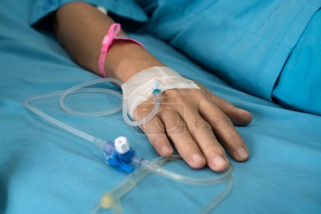 Téléchargez les photos : Patient woman hand with saline solution intravenous (IV) after surgery. - en image libre de droit
