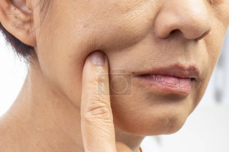 Flabby and wrinkled skin on senior woman face.