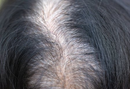 Aîné femme asiatique préoccupation au sujet des cheveux gris dans la ménopause.