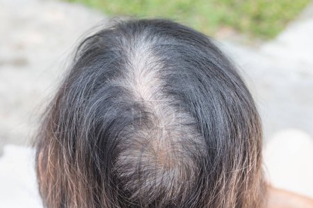 Senior aged asian woman concern about gray hair in menopause.