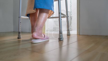 Pacientes de edad avanzada pies hinchados o edema pierna caminar en el baño.