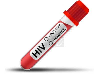 Foto de Tubo de prueba VIH con muestra de líquido rojo aislado, renderizado 3d - Imagen libre de derechos