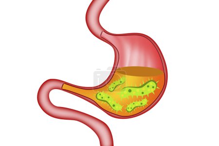 Foto de Virus y bacterias dentro del estómago humano, 3d renderizado - Imagen libre de derechos