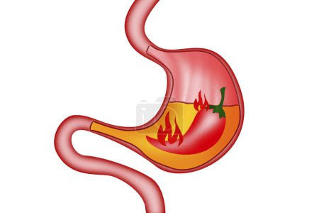 Stomach heartburn from chili pepper, 3d rendering