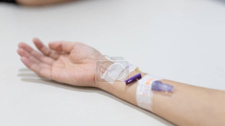 Foto de Arm puncture for intravenous infusion or medication for hospitalized patients, Treatment of patients with intravenous injections to allow the patient to receive the drug directly. - Imagen libre de derechos