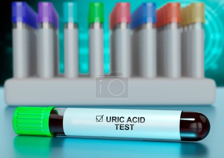 Muestra de sangre humana en el tubo para analizar los niveles de ácido úrico. Ilustración 3D