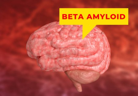 Photo for Beta Amyloids are peptides with 36-43 amino acids and the main constituent of the plaques observed in the brains of patients with Alzheimer's disease. 3D Illustration - Royalty Free Image