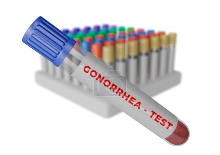Foto de Muestra de sangre humana en el tubo para la prueba de gonorrea. Ilustración 3D - Imagen libre de derechos